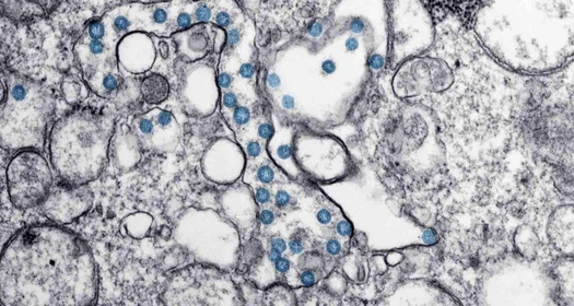 coronavirus-microscope-image