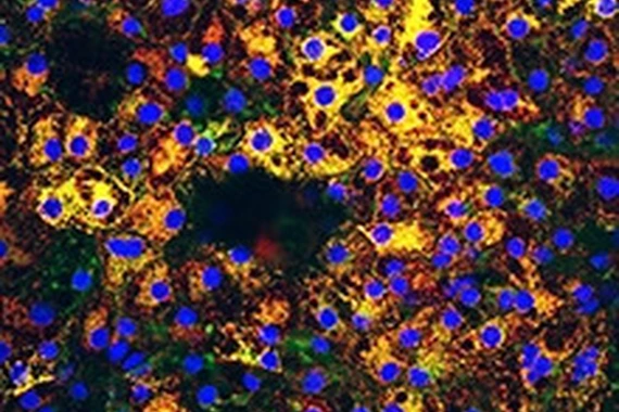 Liver cells